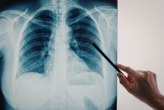 Chest Imaging