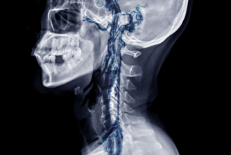 Head & Neck Radiology